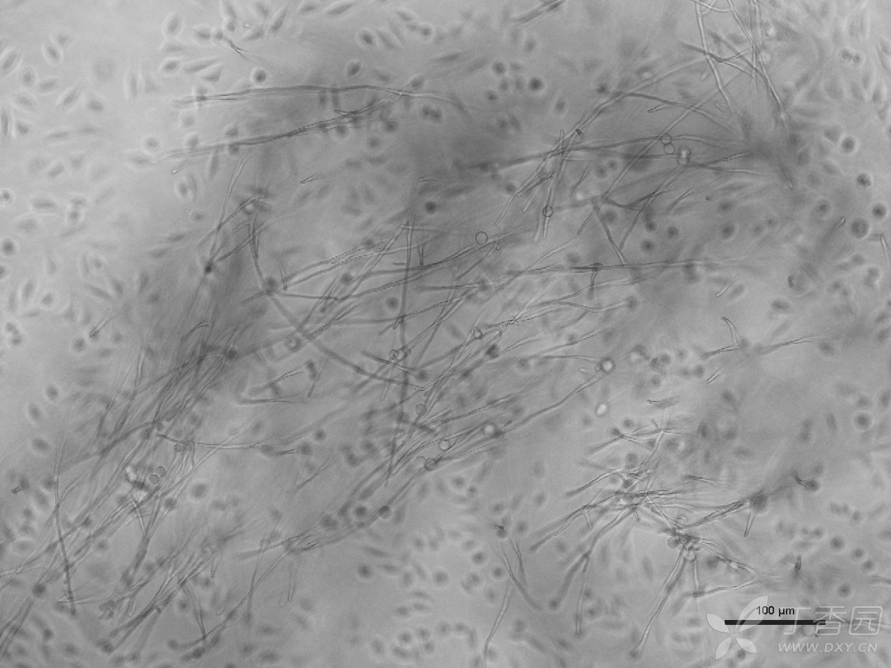 常见菌类污染图片示例 细胞技术讨论版-丁香园论坛