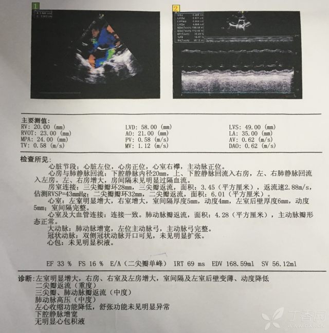 ③(住院第   天)复查心脏彩超