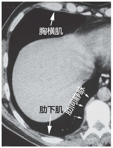 fig.6 胸横肌和肋下肌