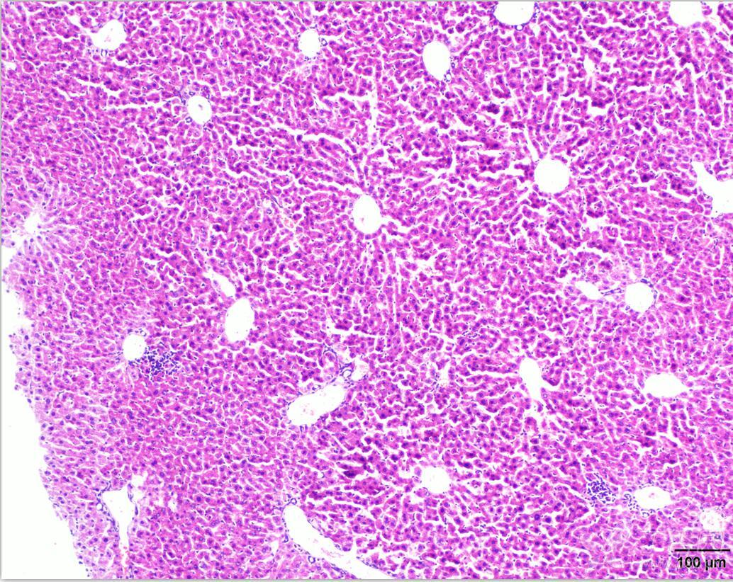 求助 请大神帮看看小鼠肝脏he染色切片