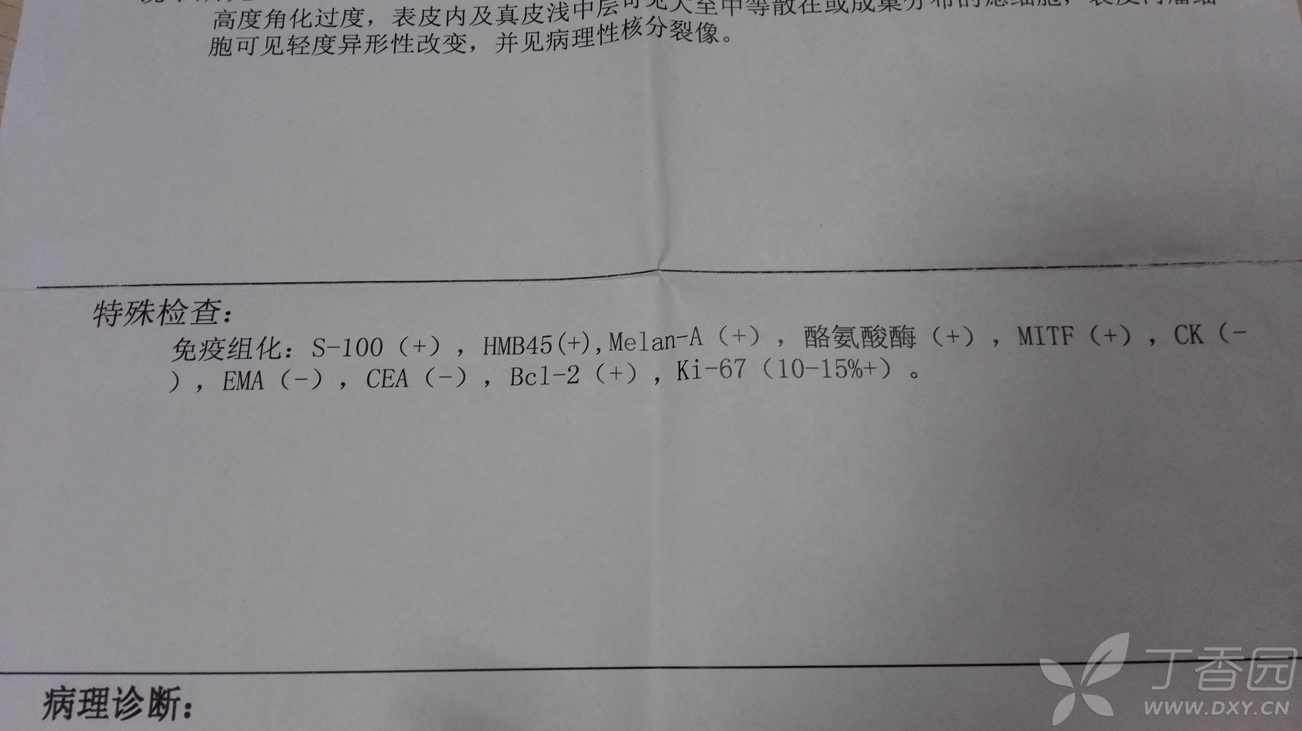 恶性黑色素瘤.患者女,50岁,5年前左足根部色素性丘疹,渐进性增大.