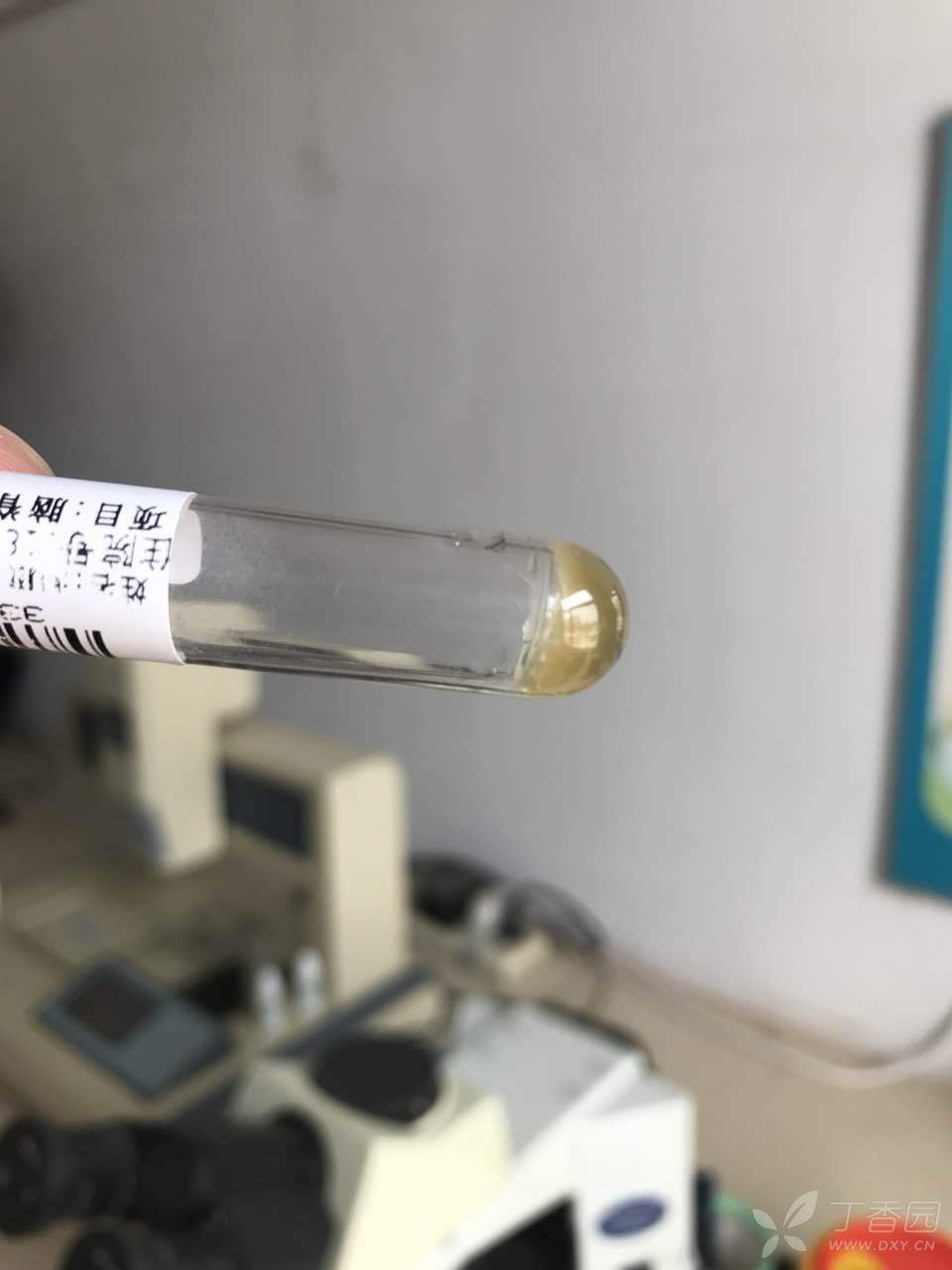 过山车一样的脑脊液变化,揍死我也想不起如何解释 [病例帖]