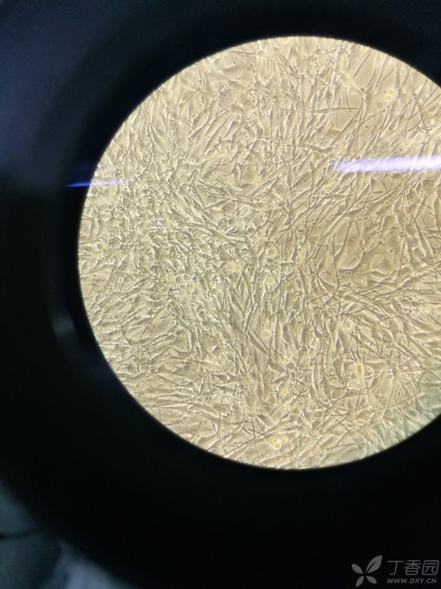kgn 人卵巢颗粒细胞