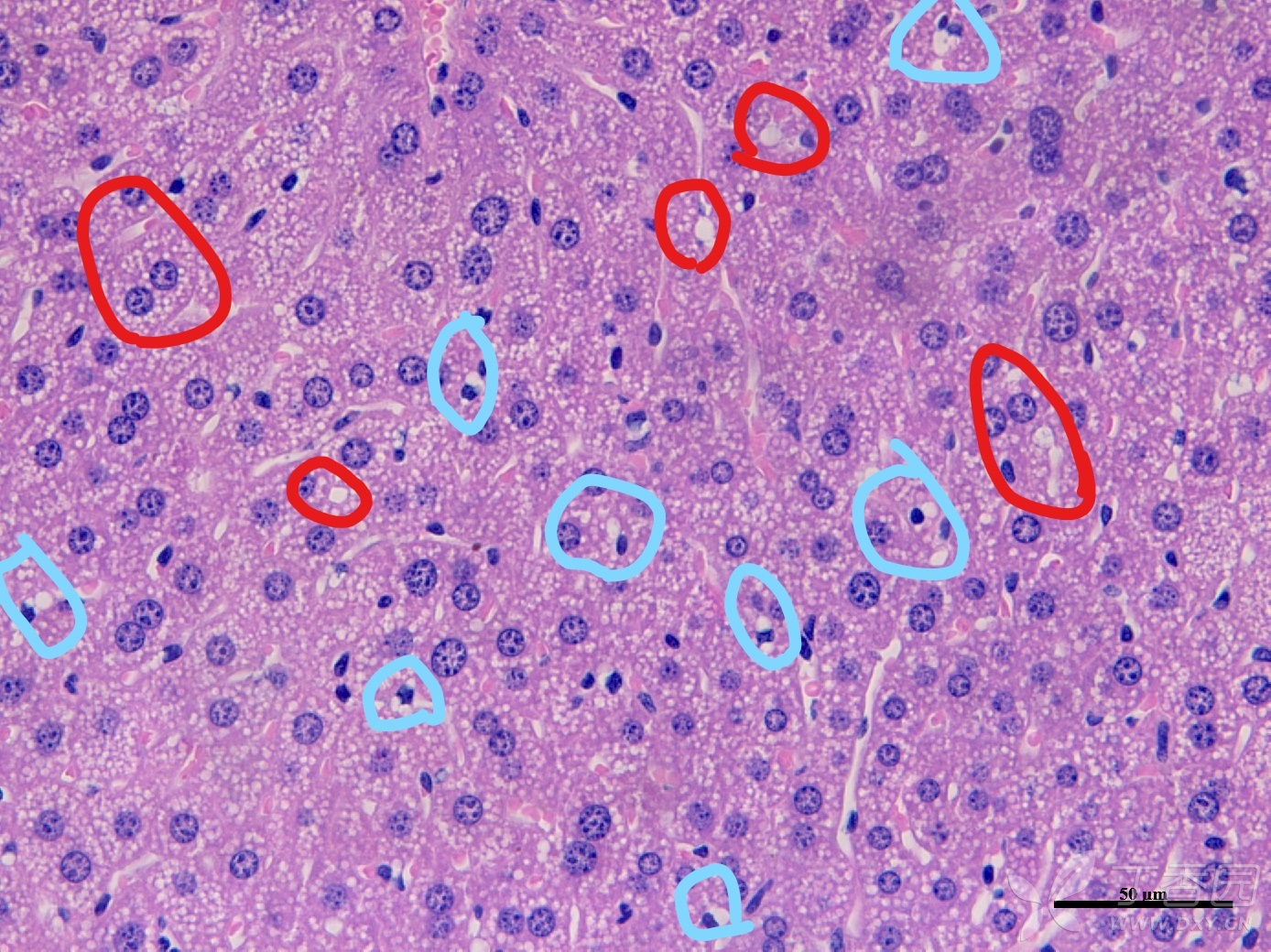 普脂小鼠肝脏有脂肪变么,如题,做的小鼠病理he切片,发现对照组肝脏