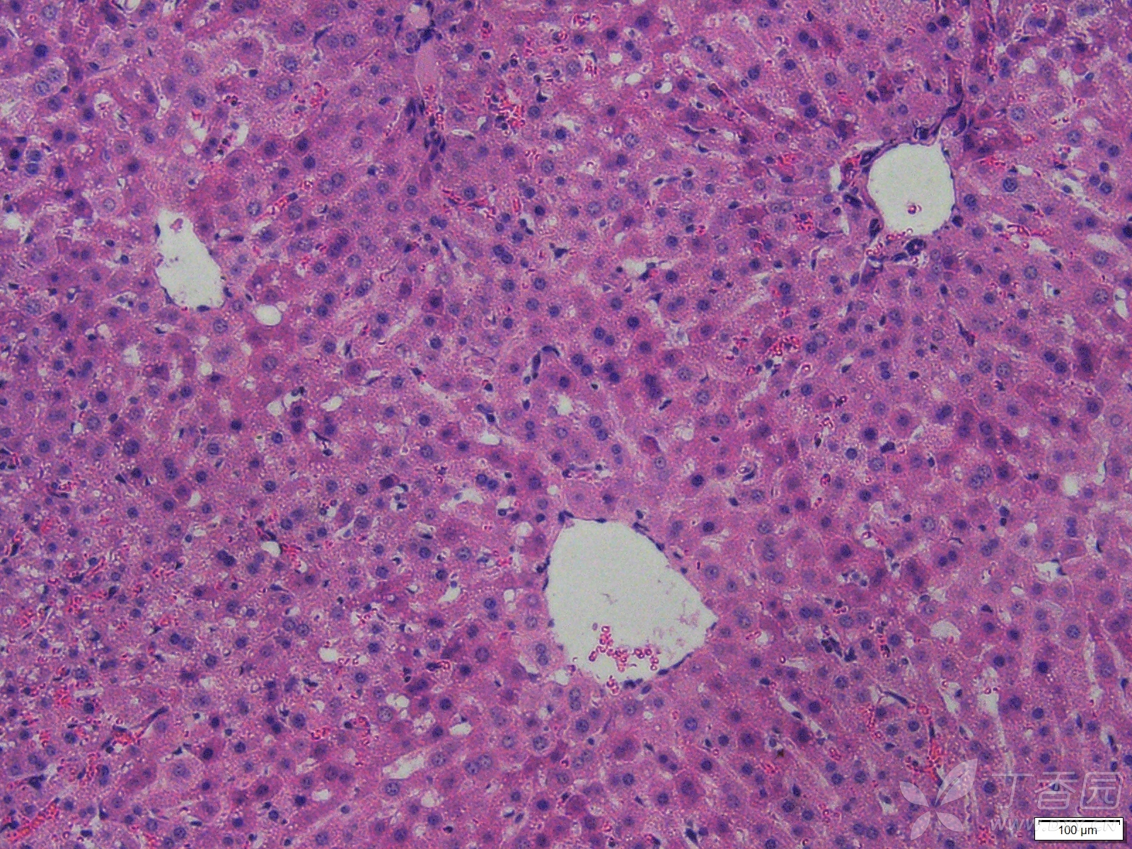 小鼠肝脏he染色病理切片分析
