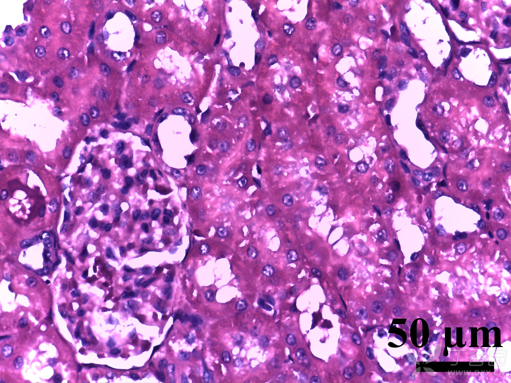 求助大神教我看肾的石蜡切片,下面是切片图片.我是小白,求具体方法