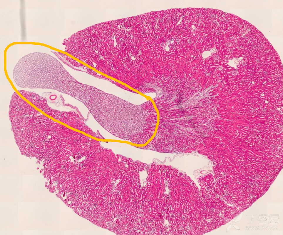 肾脏结构识别|下图为小鼠肾脏横切面he染色片子,请问图中黄圈内的结构