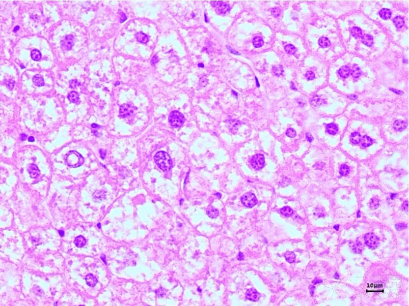 高脂模型小鼠肝脏及肾脏组织病理切片,求帮助解读