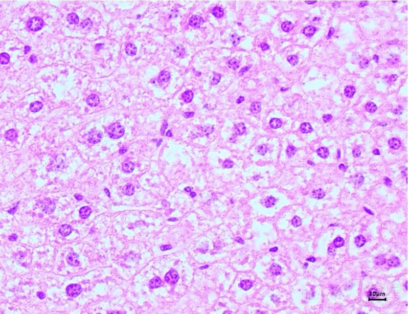 高脂模型小鼠肝脏及肾脏组织病理切片,求帮助解读