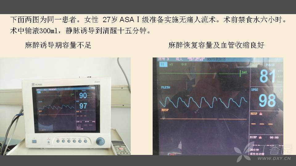 再谈脉搏氧饱和度监测