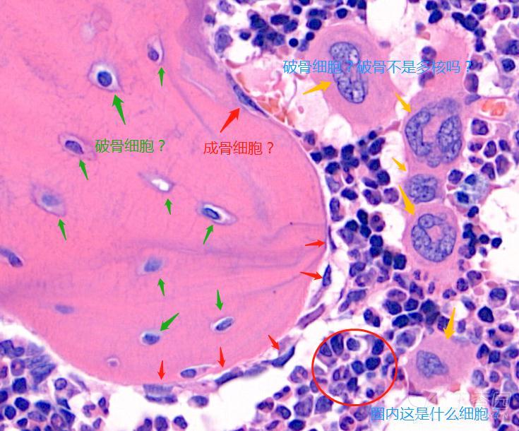 还有圈中的大量存在的细胞,是骨髓细胞?