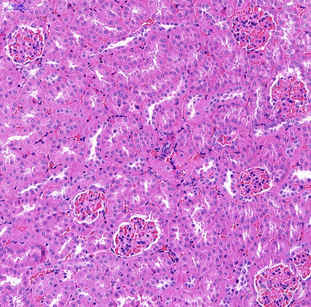 糖尿病肾脏he切片分析