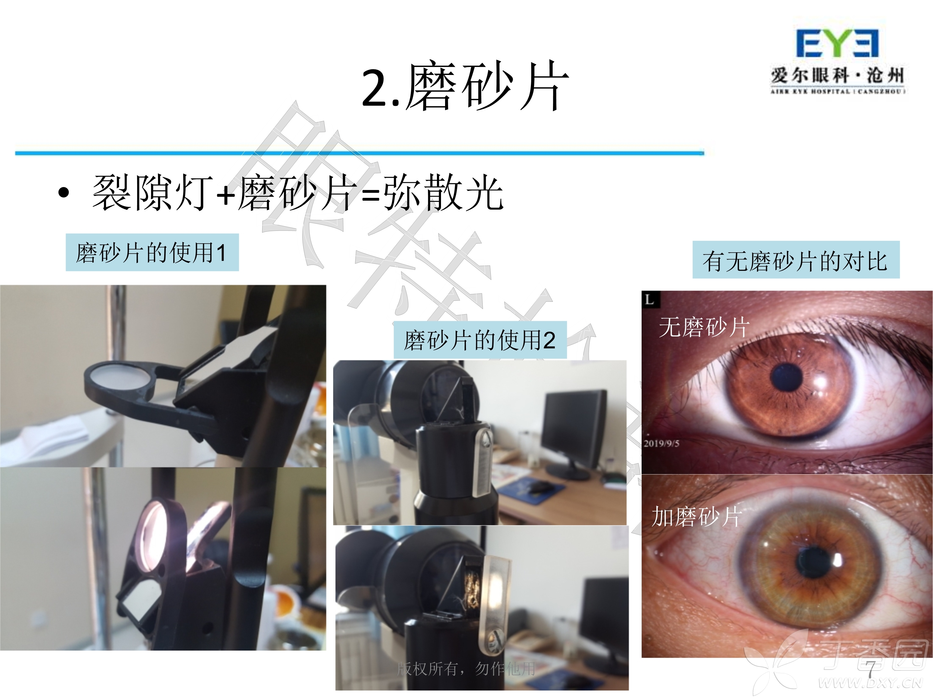 数码裂隙灯使用高阶教程 [精华]