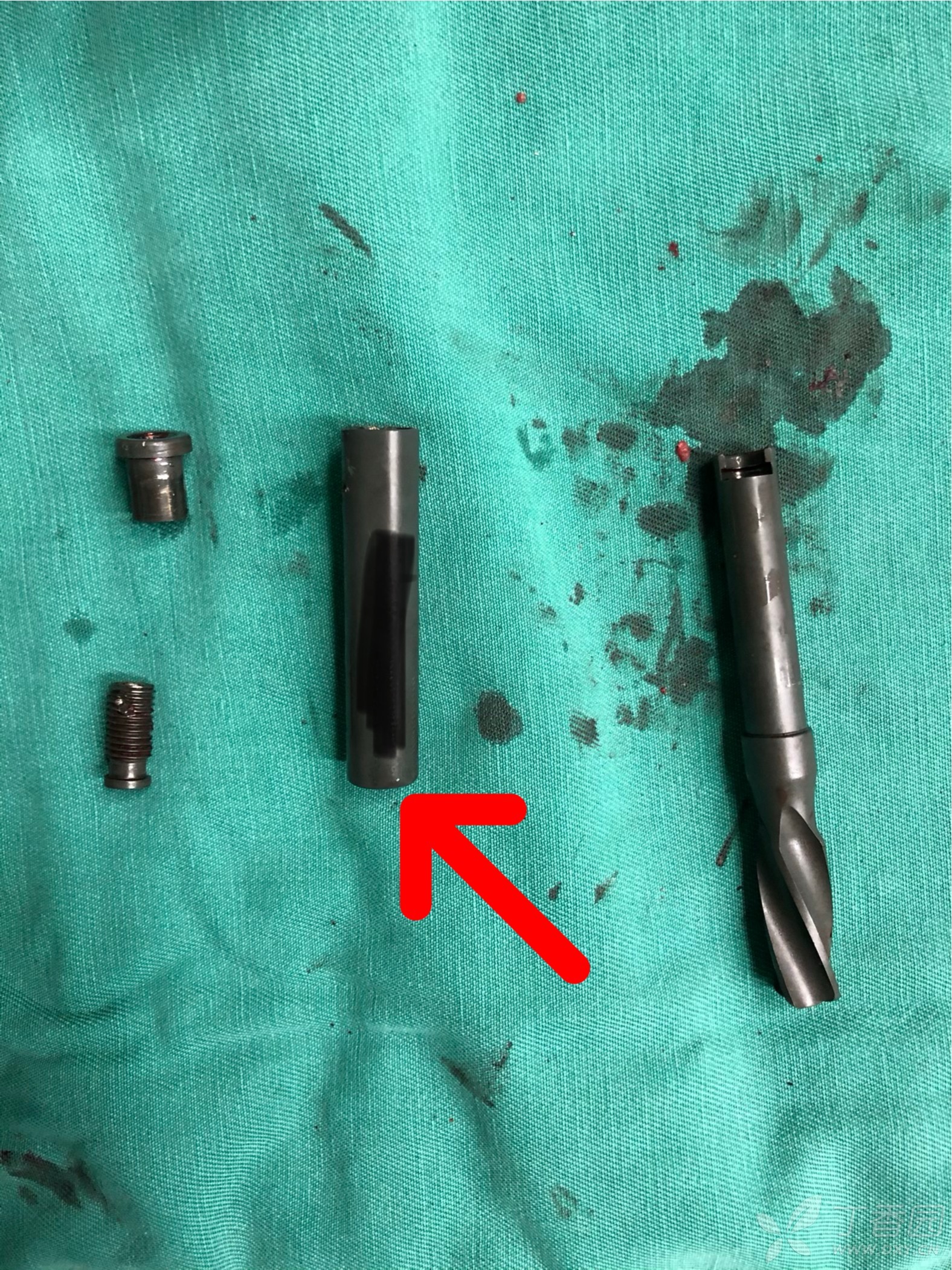 当pfna刀片尾端滑丝或尾端帽被解锁取出之后. [病例帖]