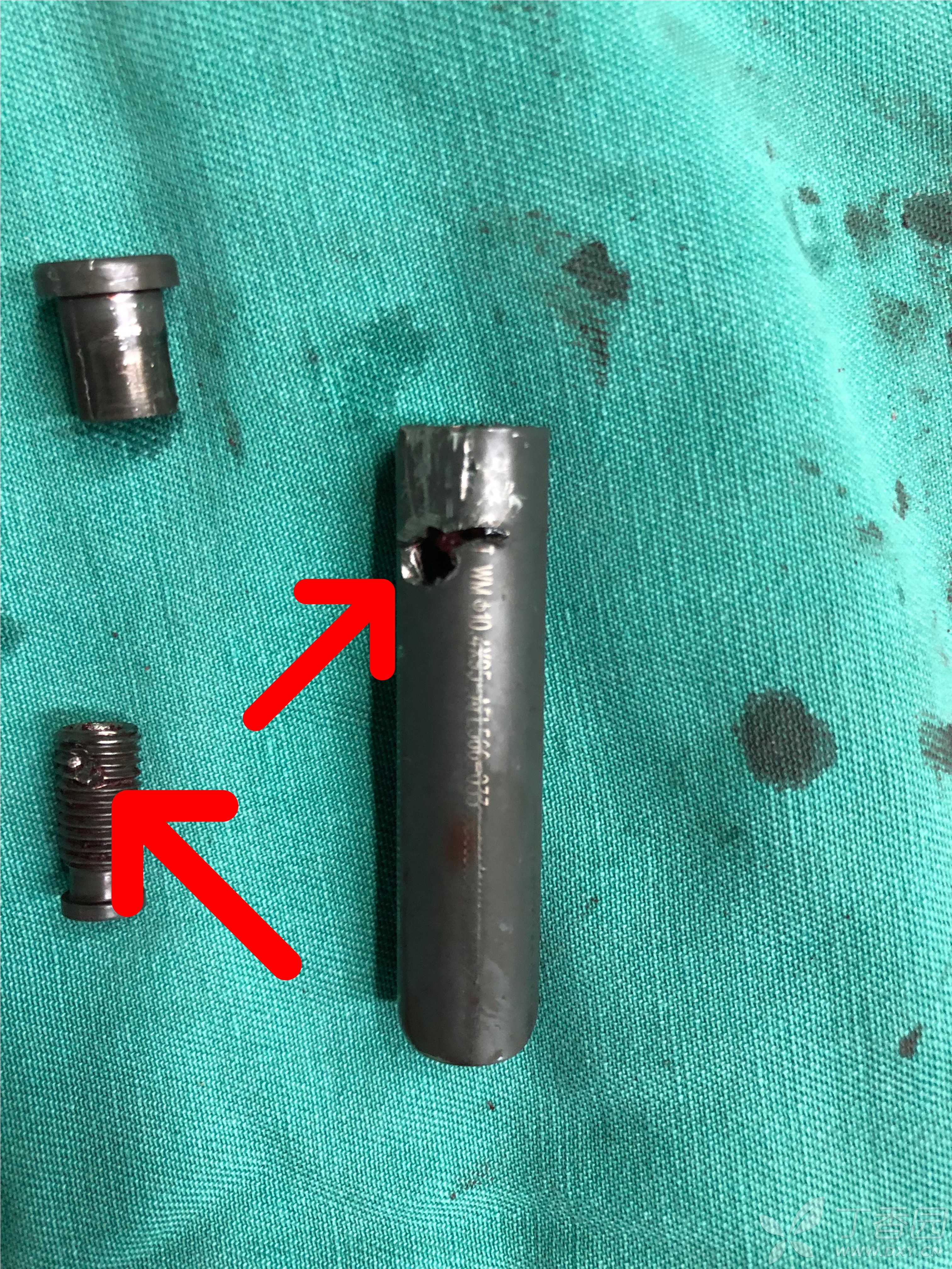 当pfna刀片尾端滑丝或尾端帽被解锁取出之后. [病例帖]