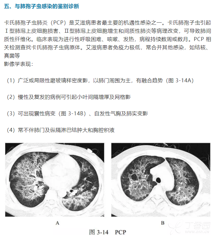 电子书精选 | 新冠肺炎ct早期征象与鉴别诊断