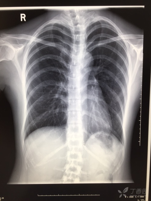 绝对好病例,请站友们积极发言!(公布结果) [病例帖]