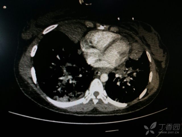 什么叫周围性病变 3238338436336788487-16w.jpg!w640