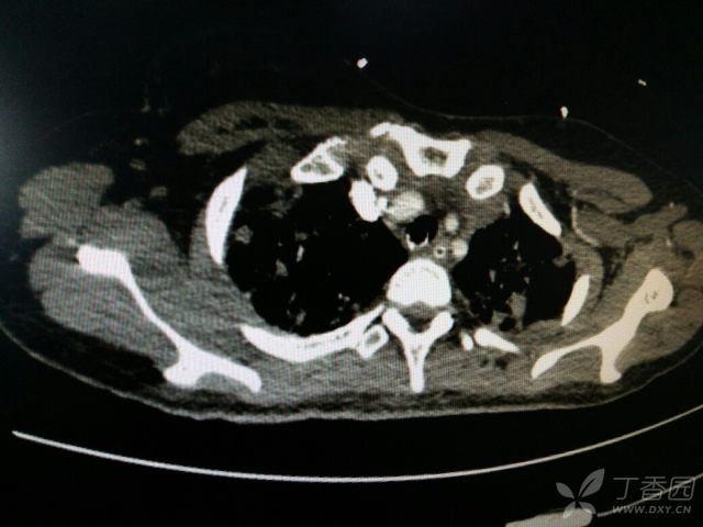 什么叫周围性病变 3238338434189265514-16w.jpg!w640