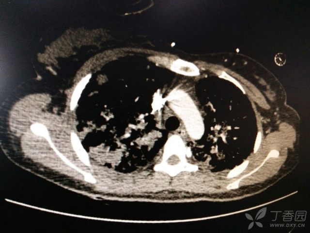 3238338436336788486-16w.jpg!w640