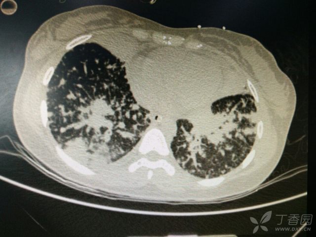 3238338410566945350-16w.jpg!w640