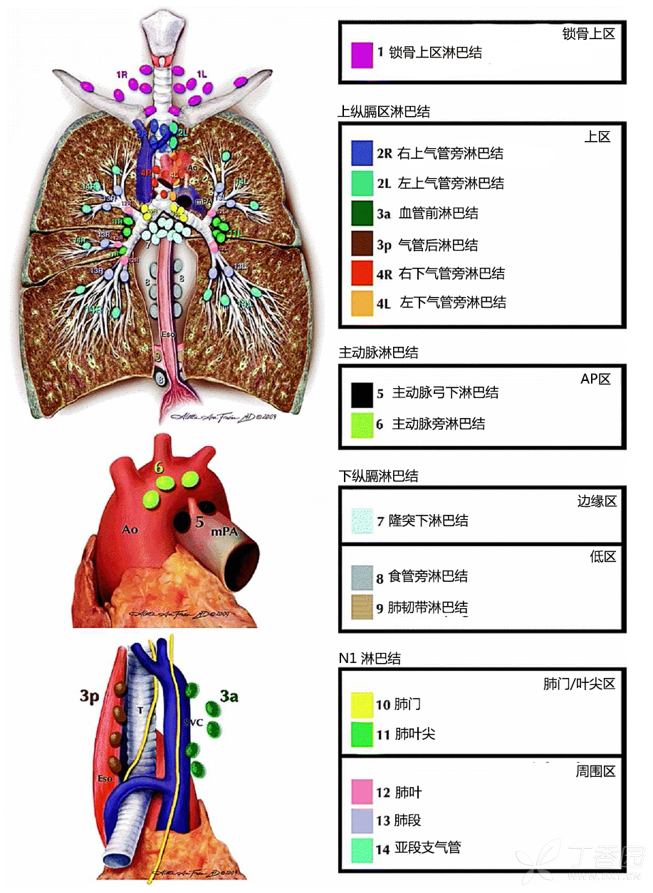 肺癌淋巴结分组图片图片