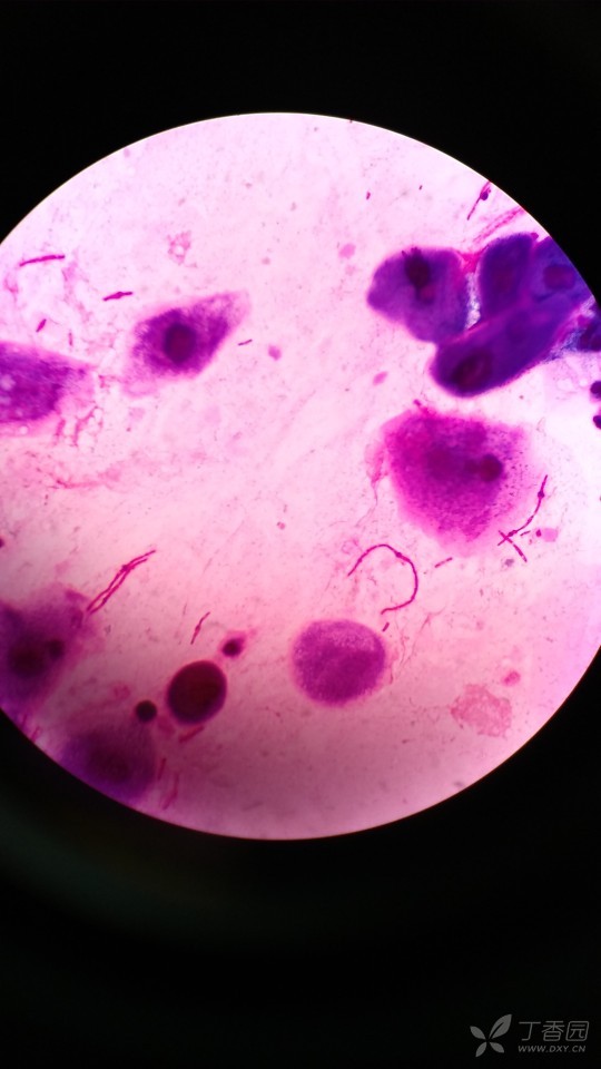 皮肤真菌显微镜下图片图片