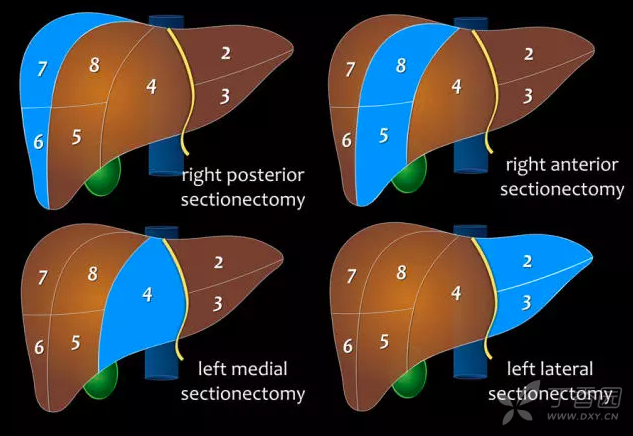 基本功学习:肝脏分段解剖图谱