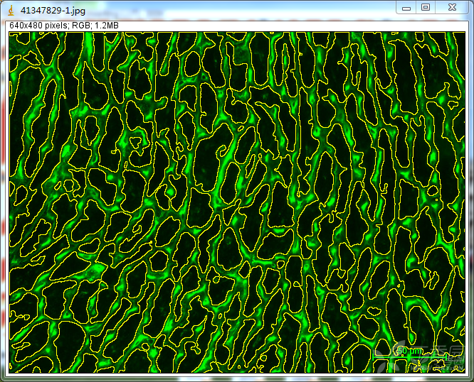 如何用image j统计wga染色心肌细胞面积
