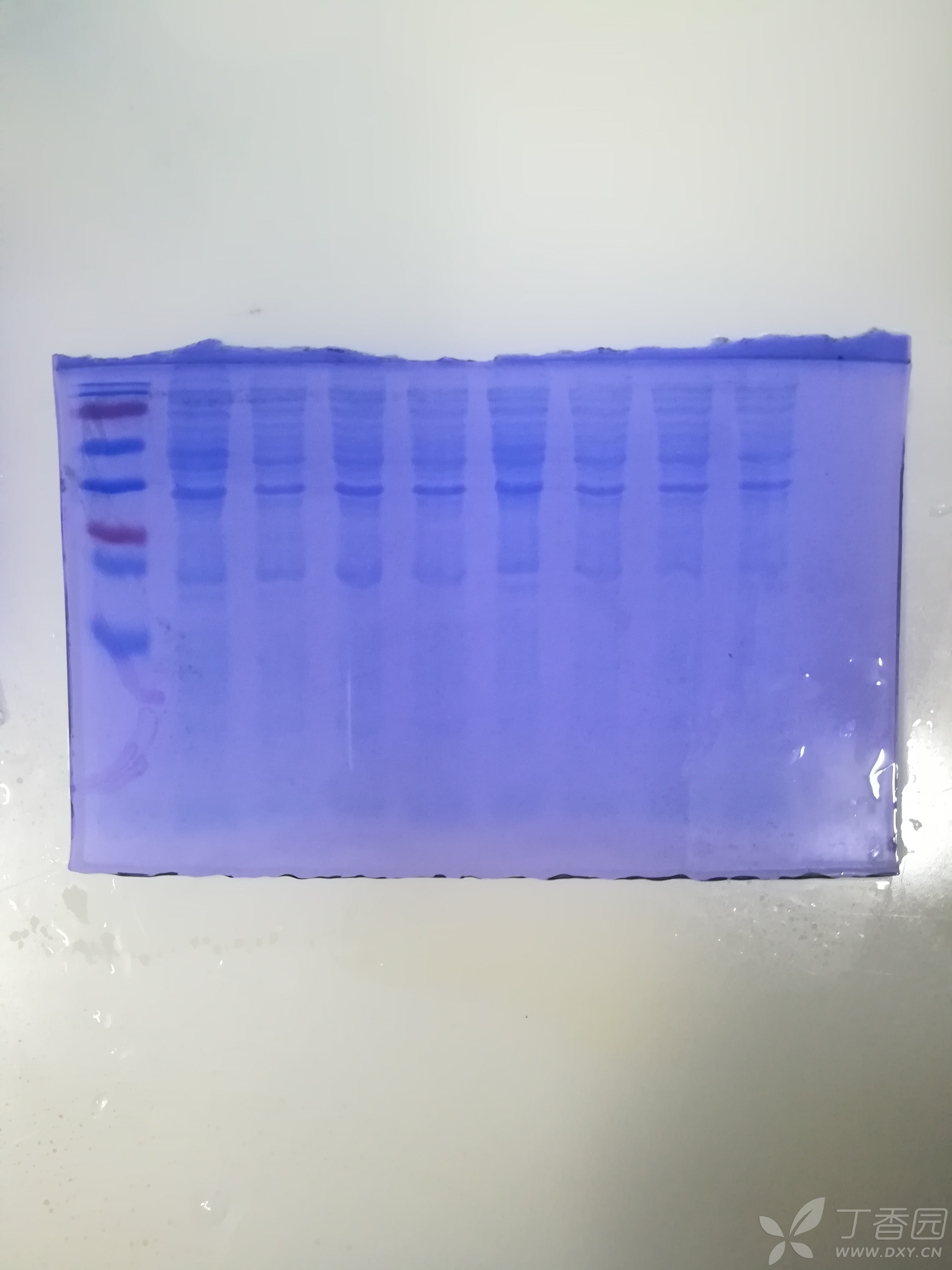 蛋白原核表达出现问题