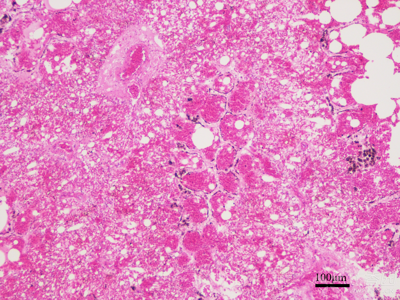 肺組織he染色,請教黑色的顆粒是啥?是毛氣管or毛細血管網中的雜質麼?