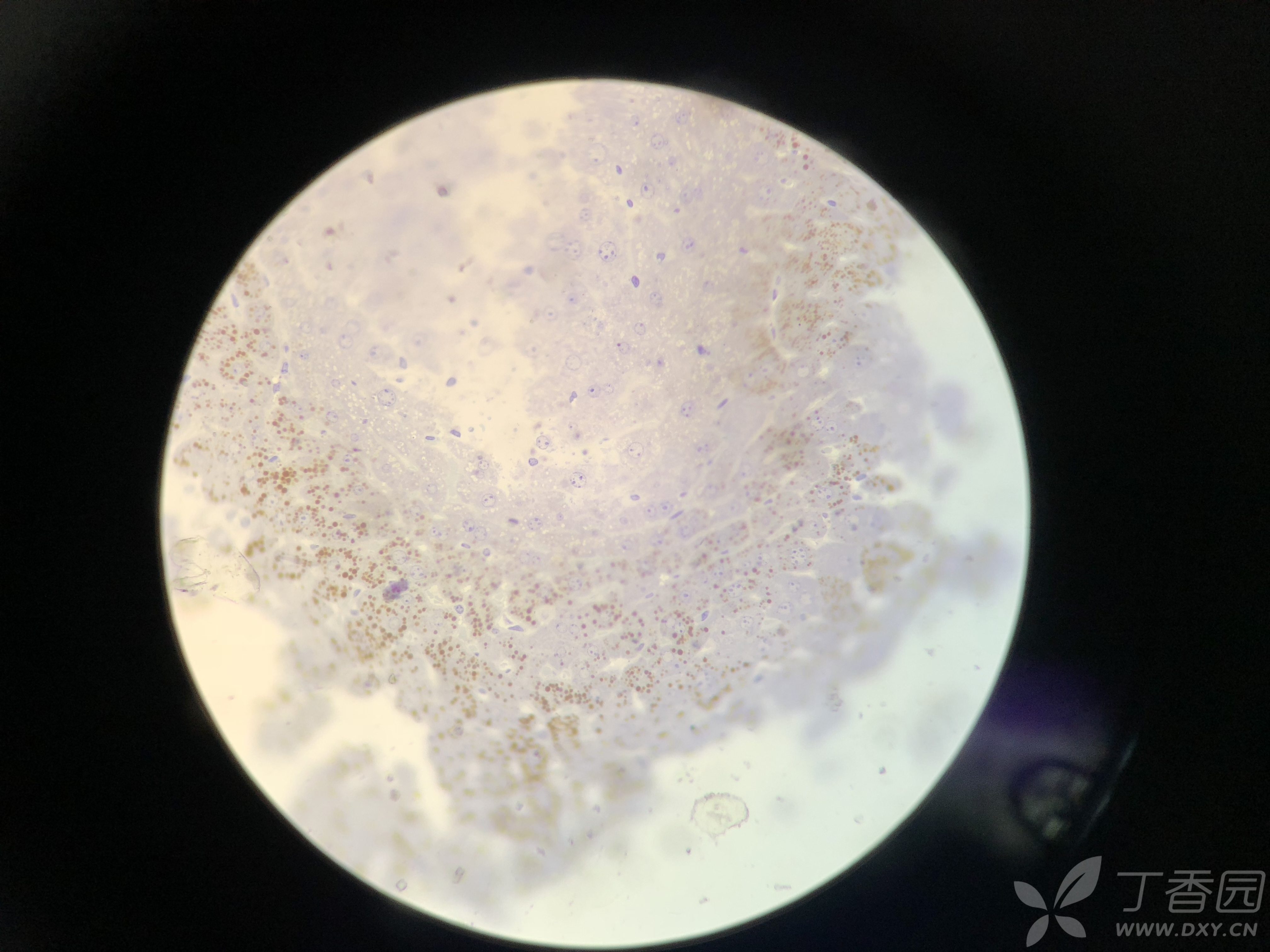 关于小鼠肝脏样本送电镜检测第一步:光镜下锇酸染色结果的问题~急急急