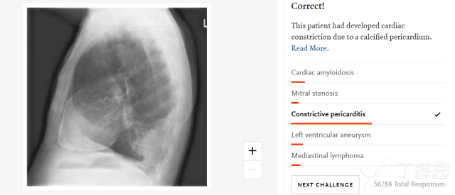 3284959915533827484-8w.png!w640