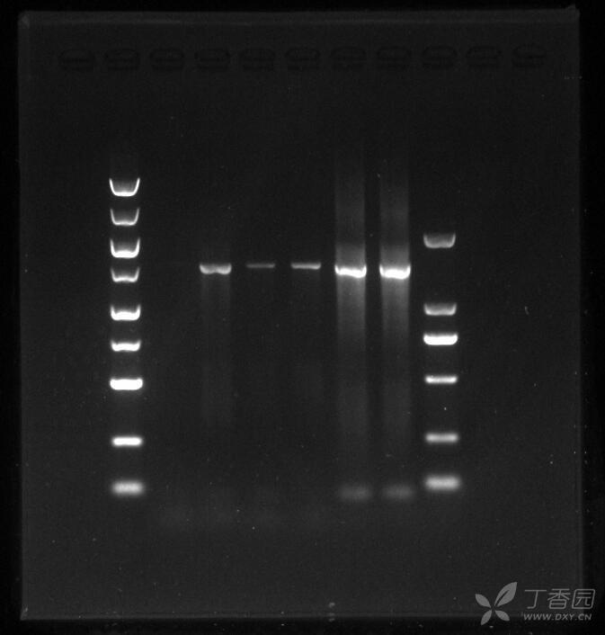 pcr图片电泳条带图片