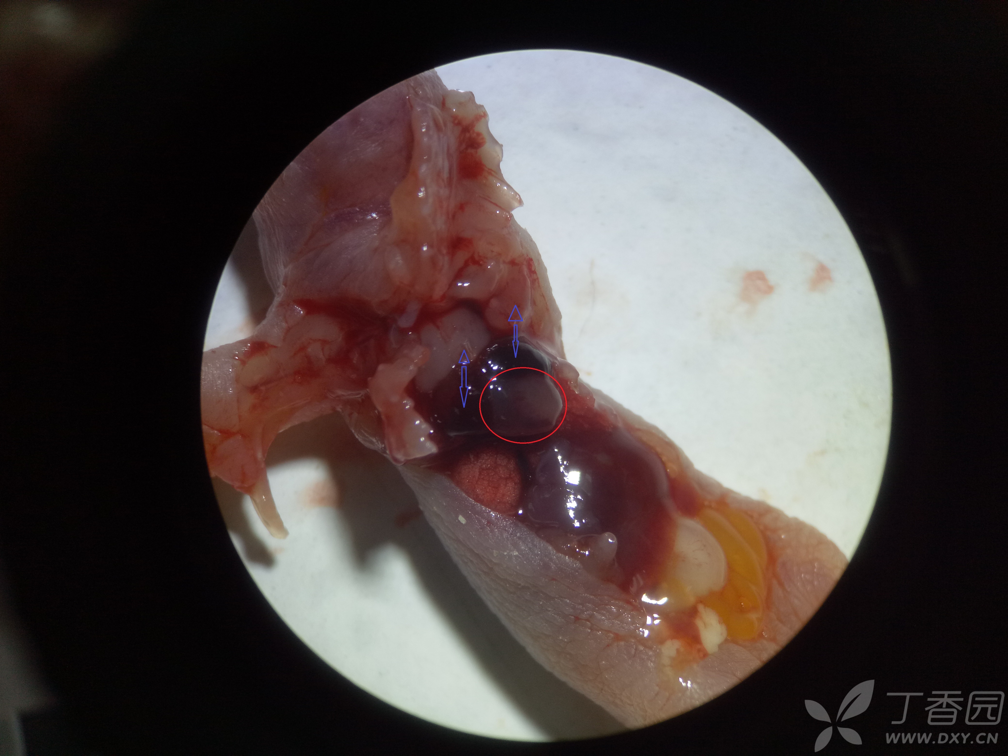 小鼠心脏整个发黑是怎么回事?