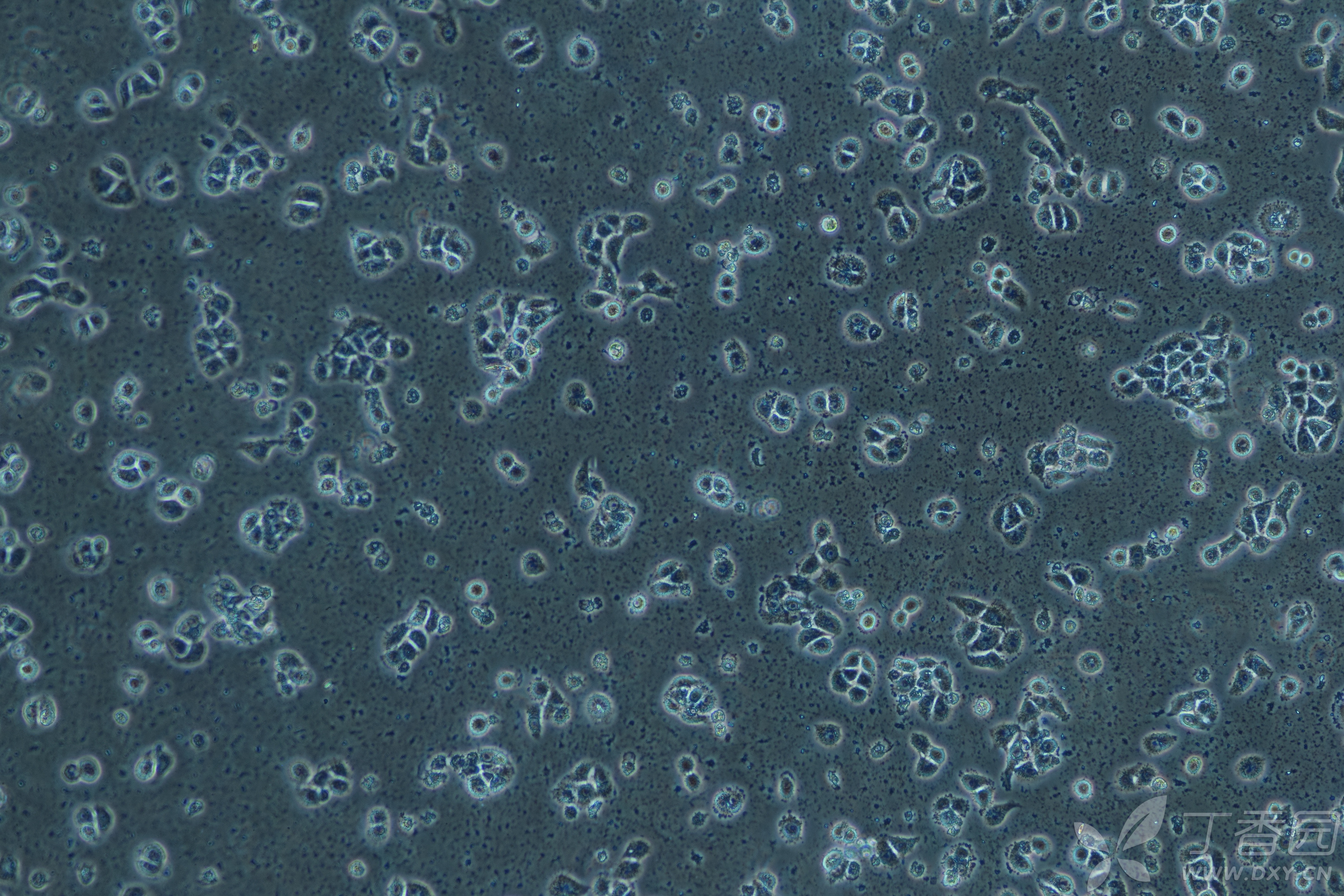 在下刚开始养16hbe,细胞一直不是很好,想请各位帮我看下到底是什么