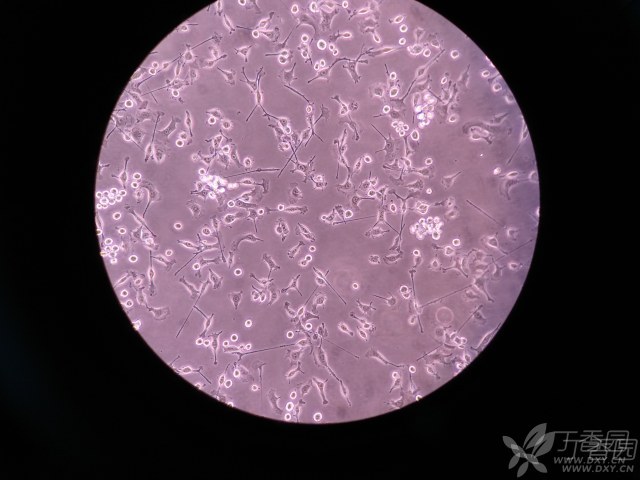 bv2小胶质细胞形态图片