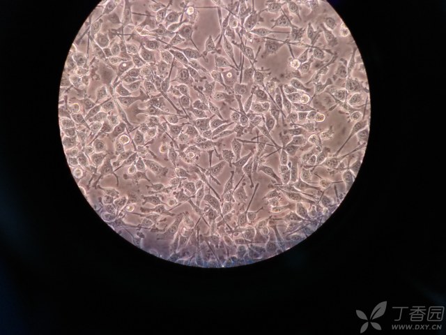 bv2小胶质细胞形态图片