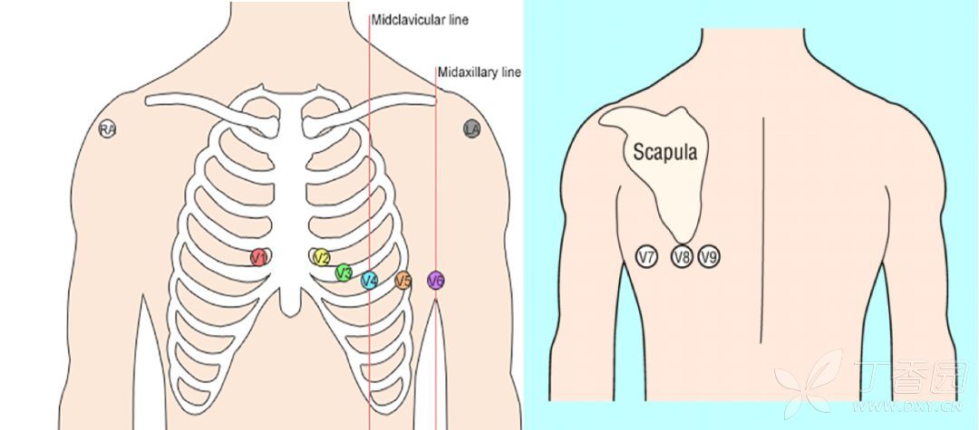 18心电图位置图片