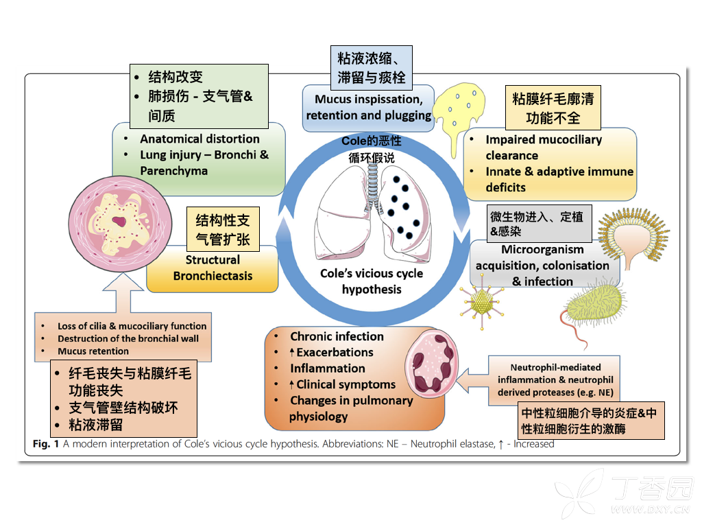 【文献学习】支气管扩张 bronchiectasis 