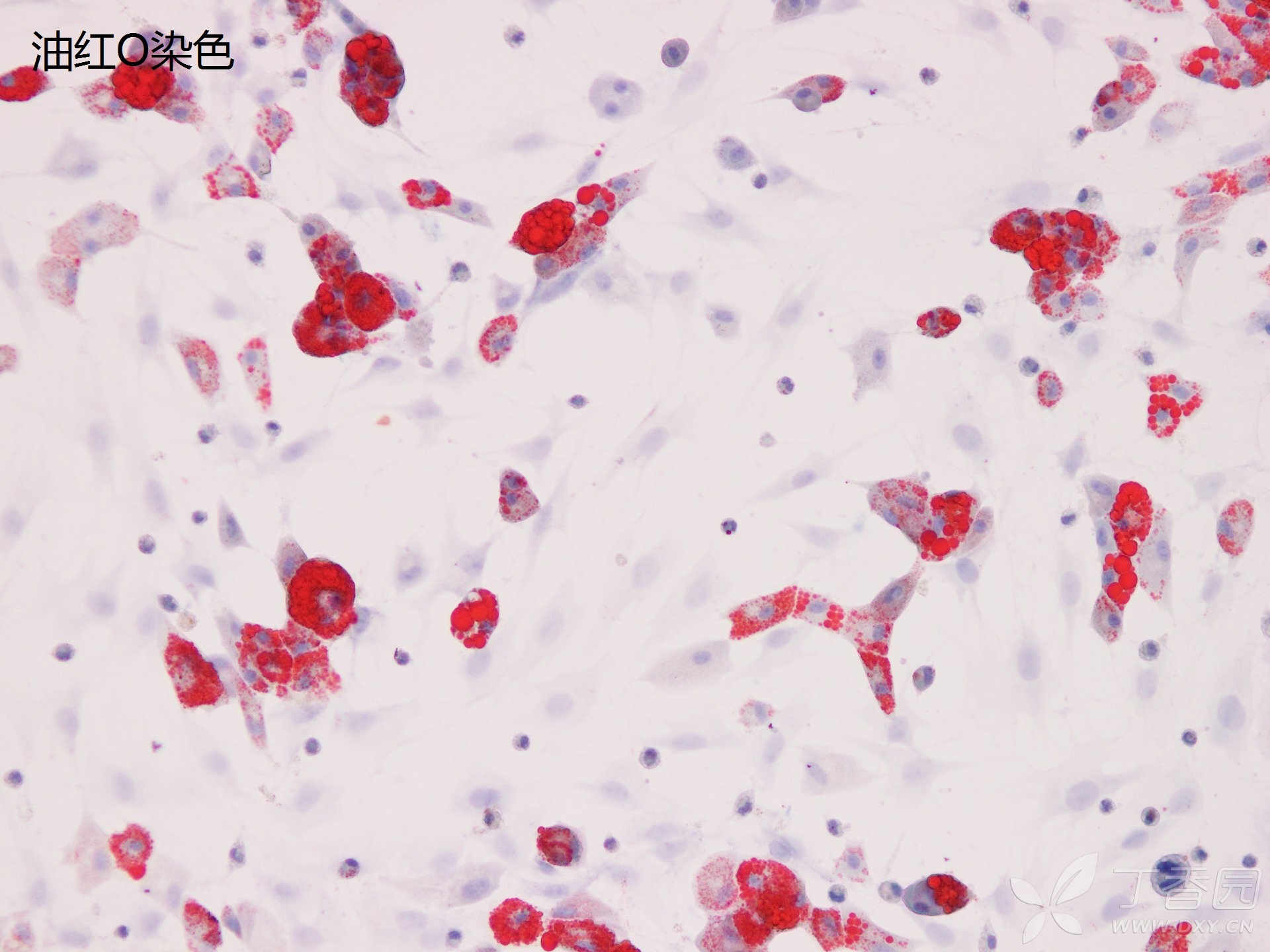 细胞爬片油红o染色实验流程