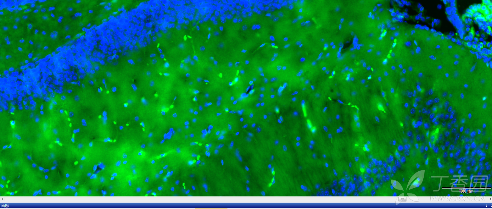 免疫荧光 cd4 小胶质细胞染色