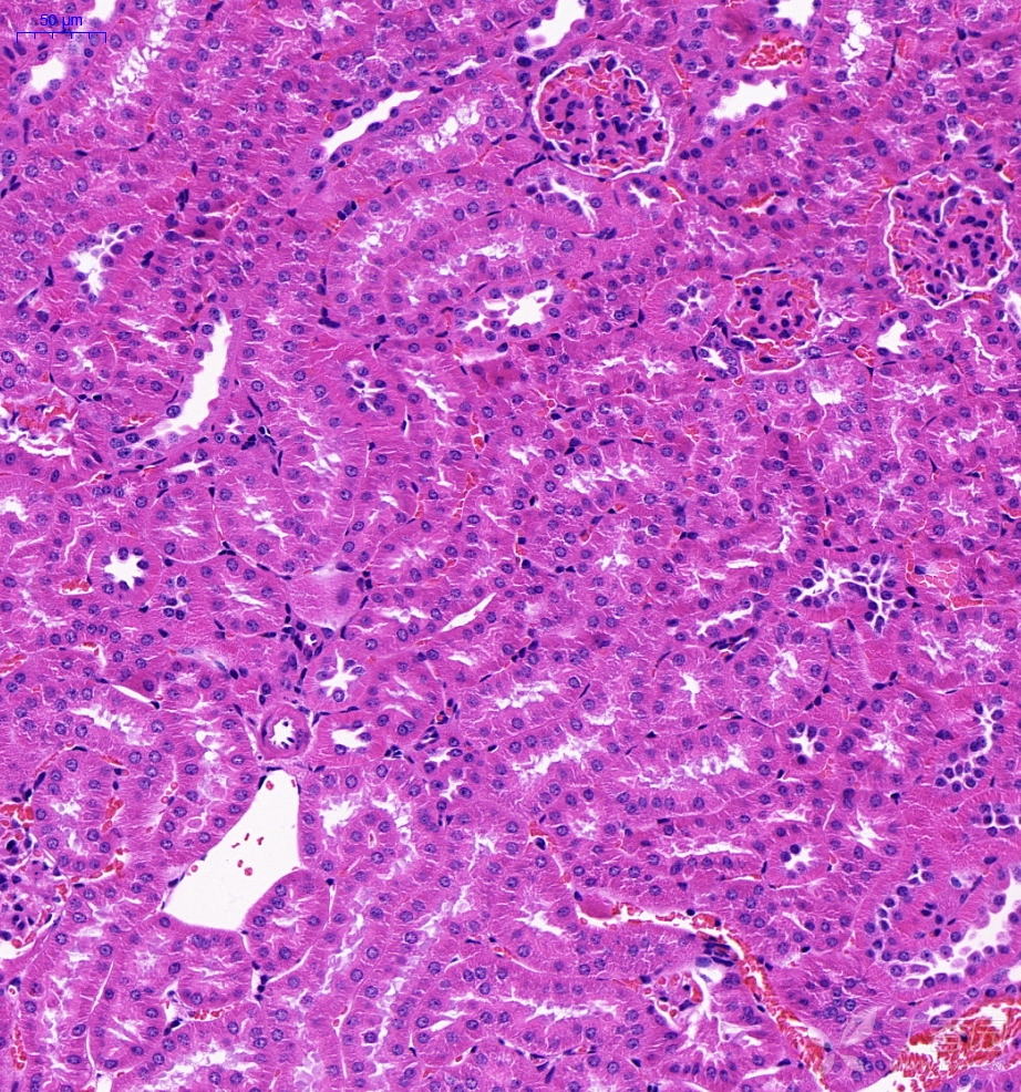 糖尿病肾脏he切片分析