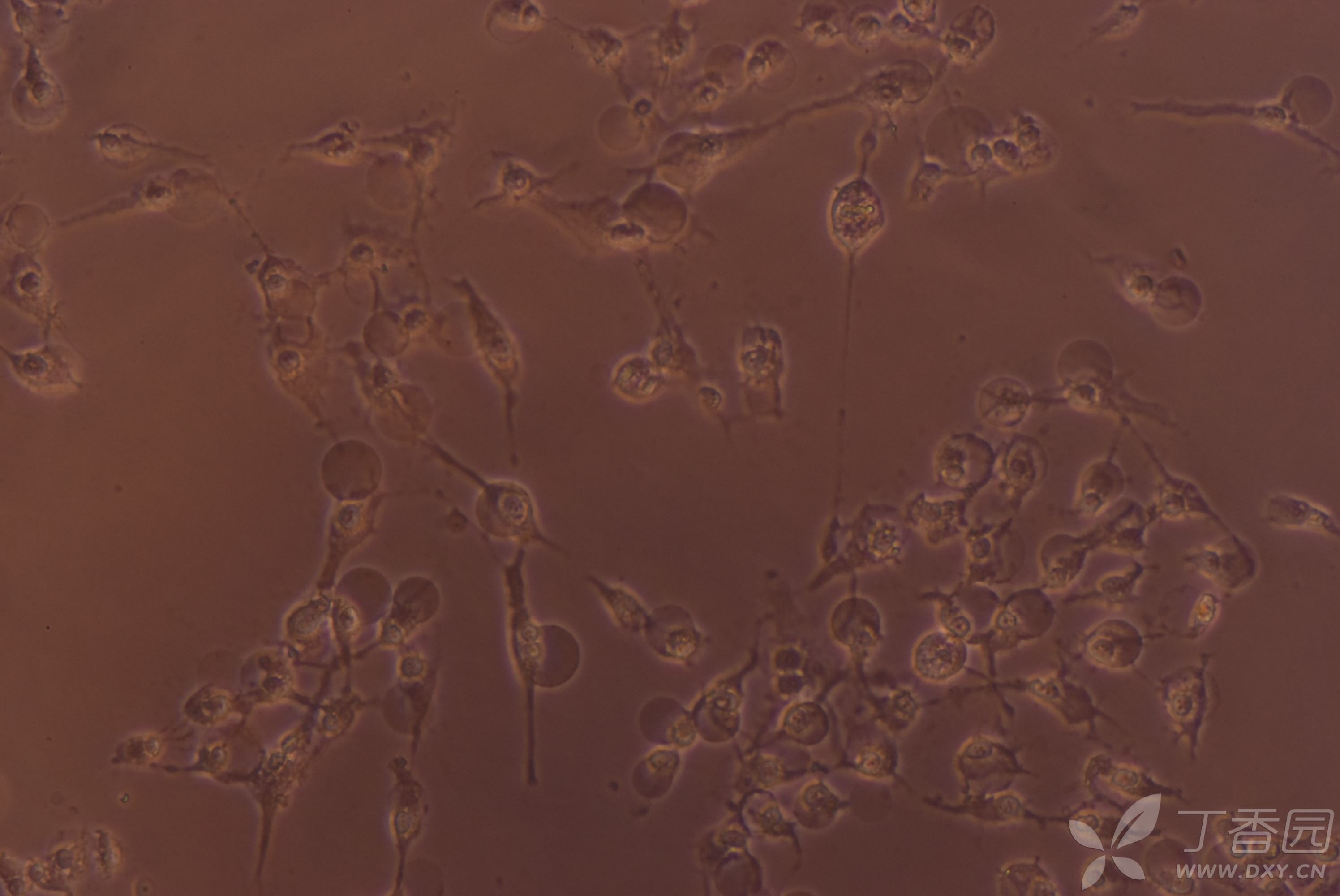 请问这是一种怎样的细胞死亡方式?