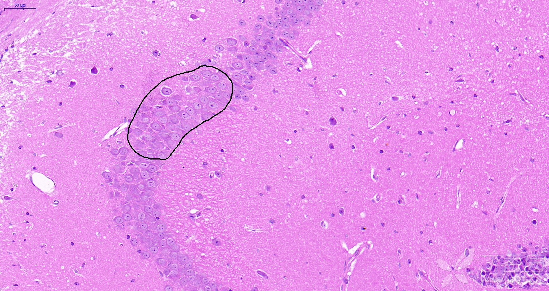 海马he染色求助