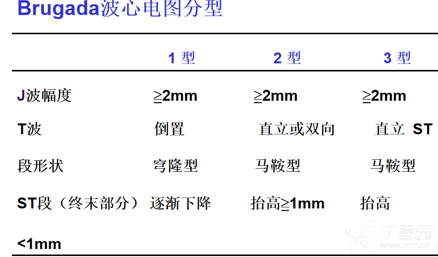 brugada波心电图分型