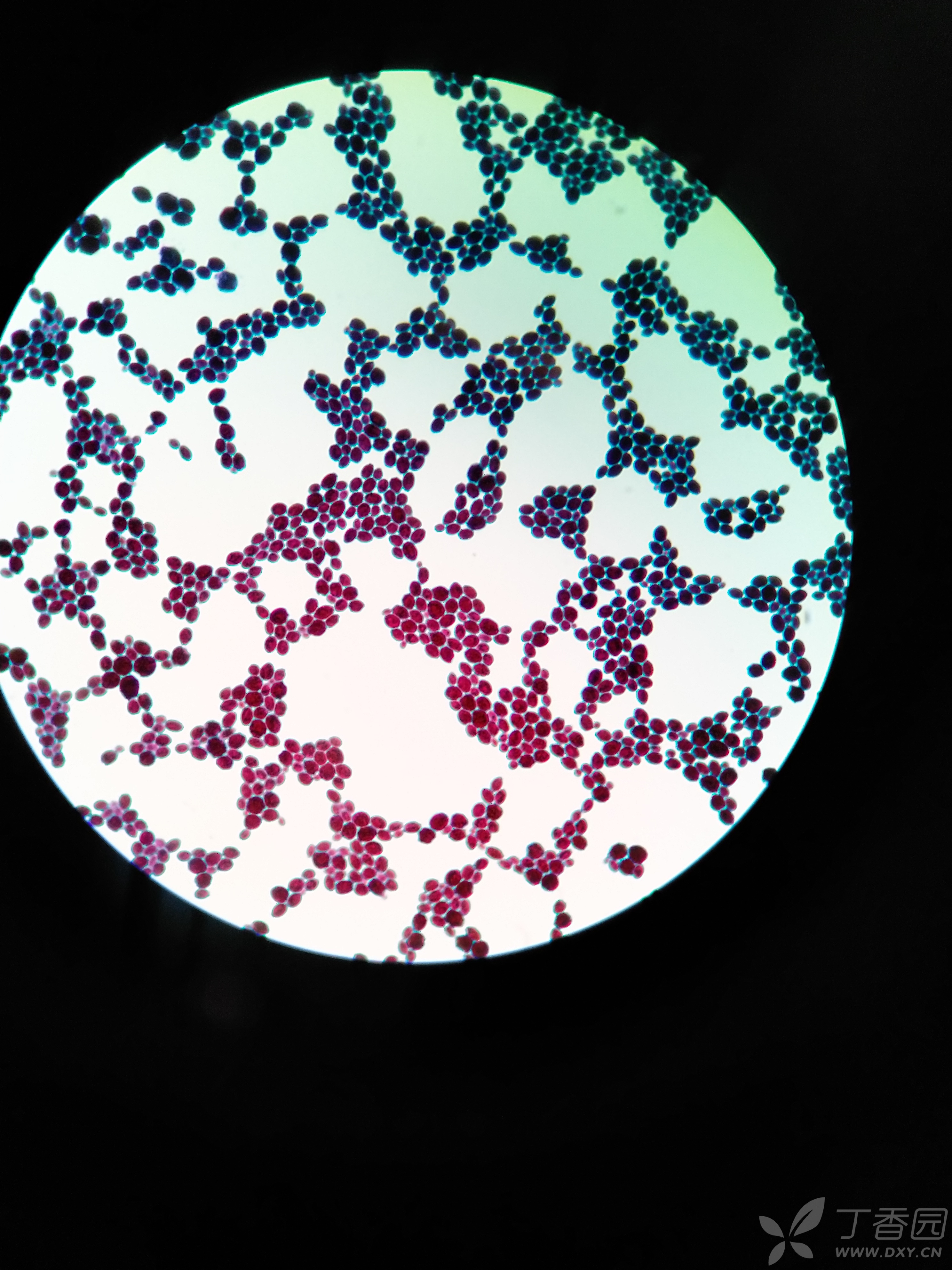 各种细菌简单染色结果图片