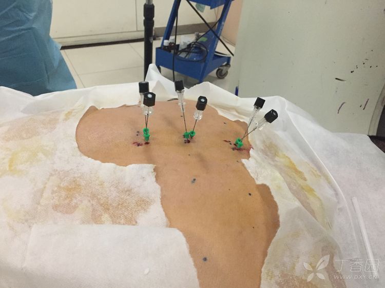 黄教授疼痛专贴学习(五):真想告别"水"手,打一针就没有