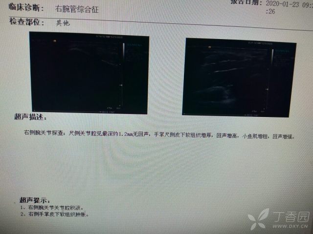 激光碎石后还疼 3404986670008304666-16w.jpg!w640